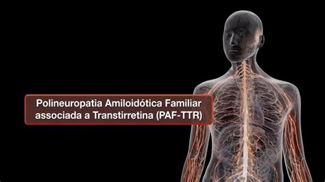 tehnologie radiologie polipoză adenomatoasă familială